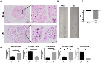 Long Non-coding RNA MSTRG.24008.1 Regulates the Regeneration of the Sciatic Nerve via the miR-331-3p–NLRP3/MAL Axis